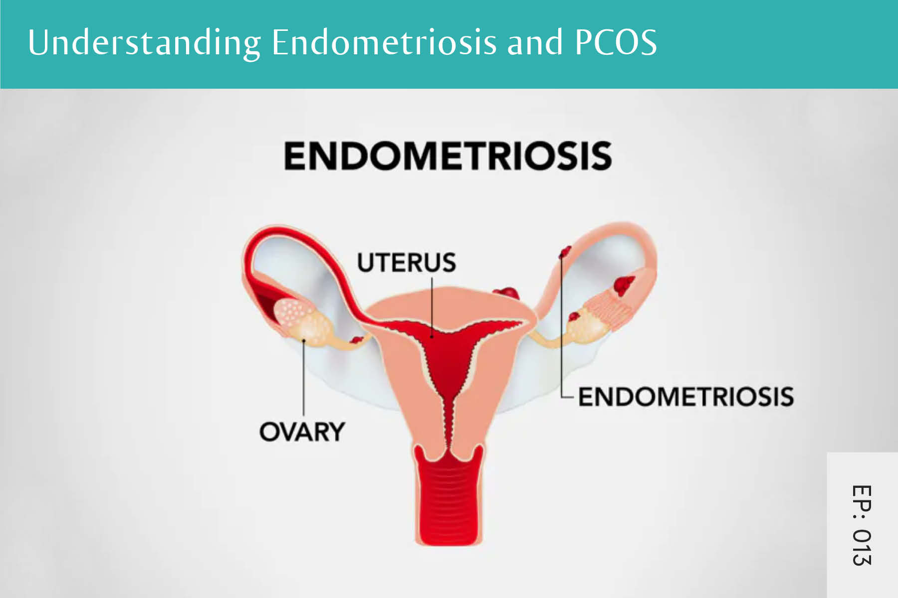 013: Understanding Endometriosis and PCOS Seven Health: Intu