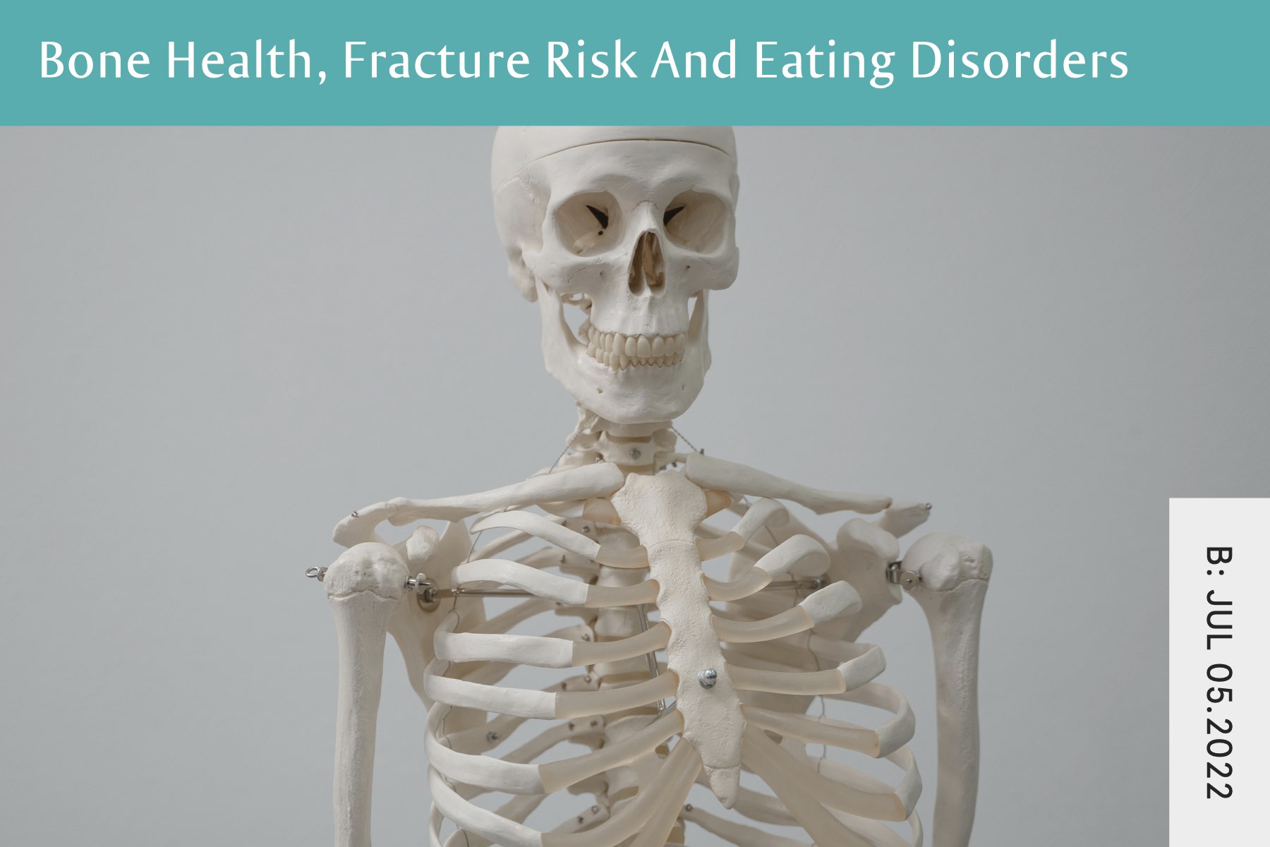 Bone Health - Seven Health: Eating Disorder Recovery and Anti Diet Nutritionist
